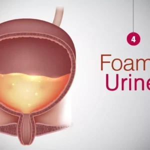 Foamy Urine No More Panic
