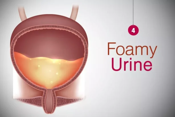 Foamy Urine No More Panic Home Special Mentality