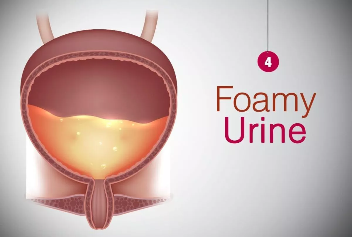 Foamy Urine No More Panic